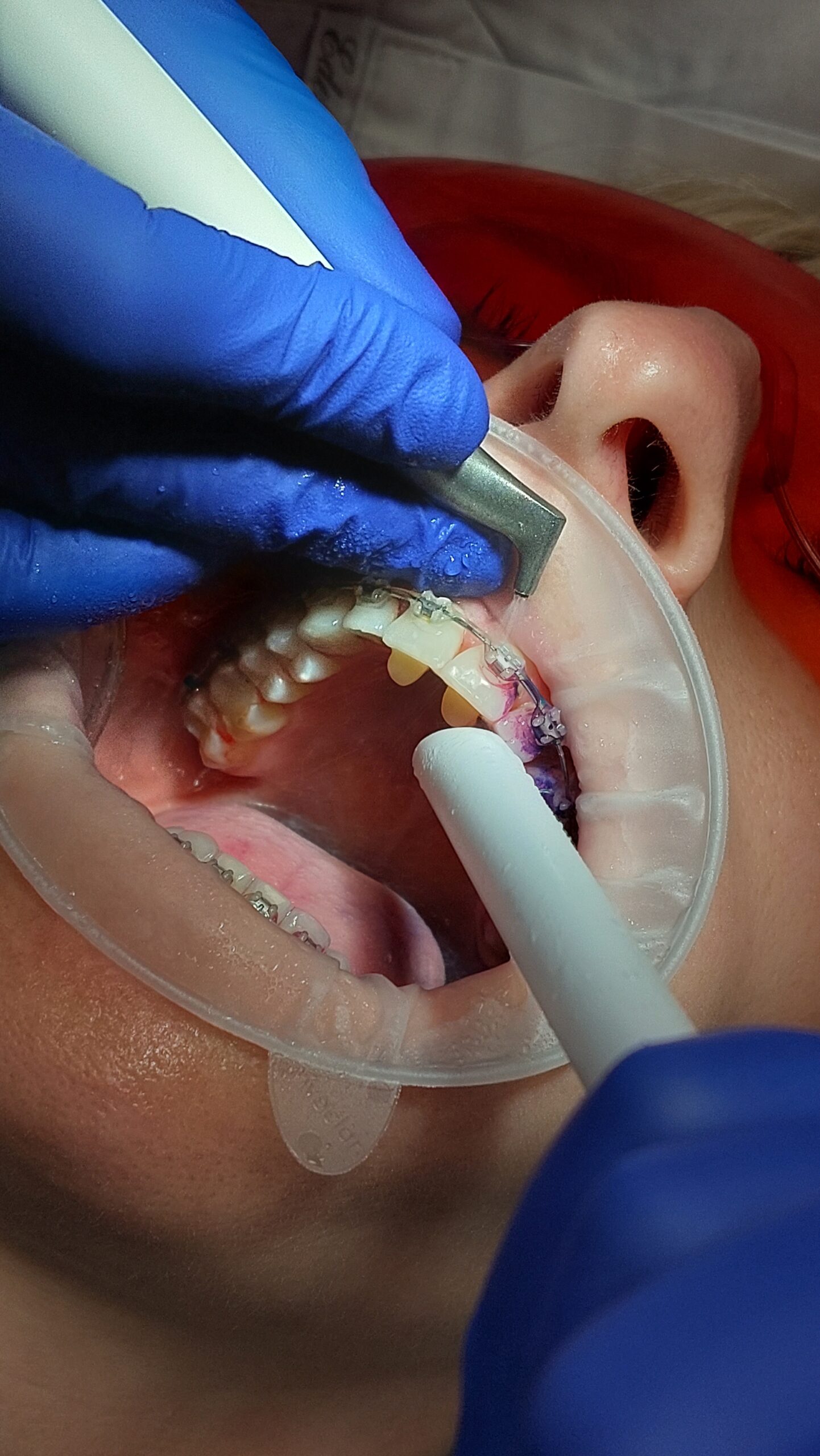 Szczecin - Profesjonalna Higienizacja Pacjenta - szkolenie podstawowe - obrazek 4