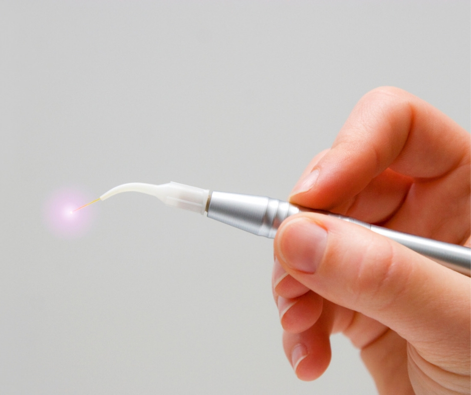 Laseroterapia pacjenta periodontologicznego - praktyka, precyzja i pewność - obrazek 4