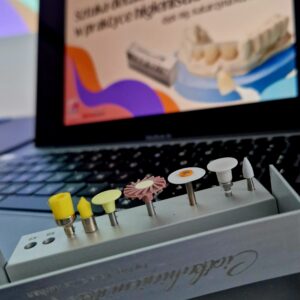 Bonding i stała uzupełnienia protetyczne w praktyce higienistki stomatologicznej